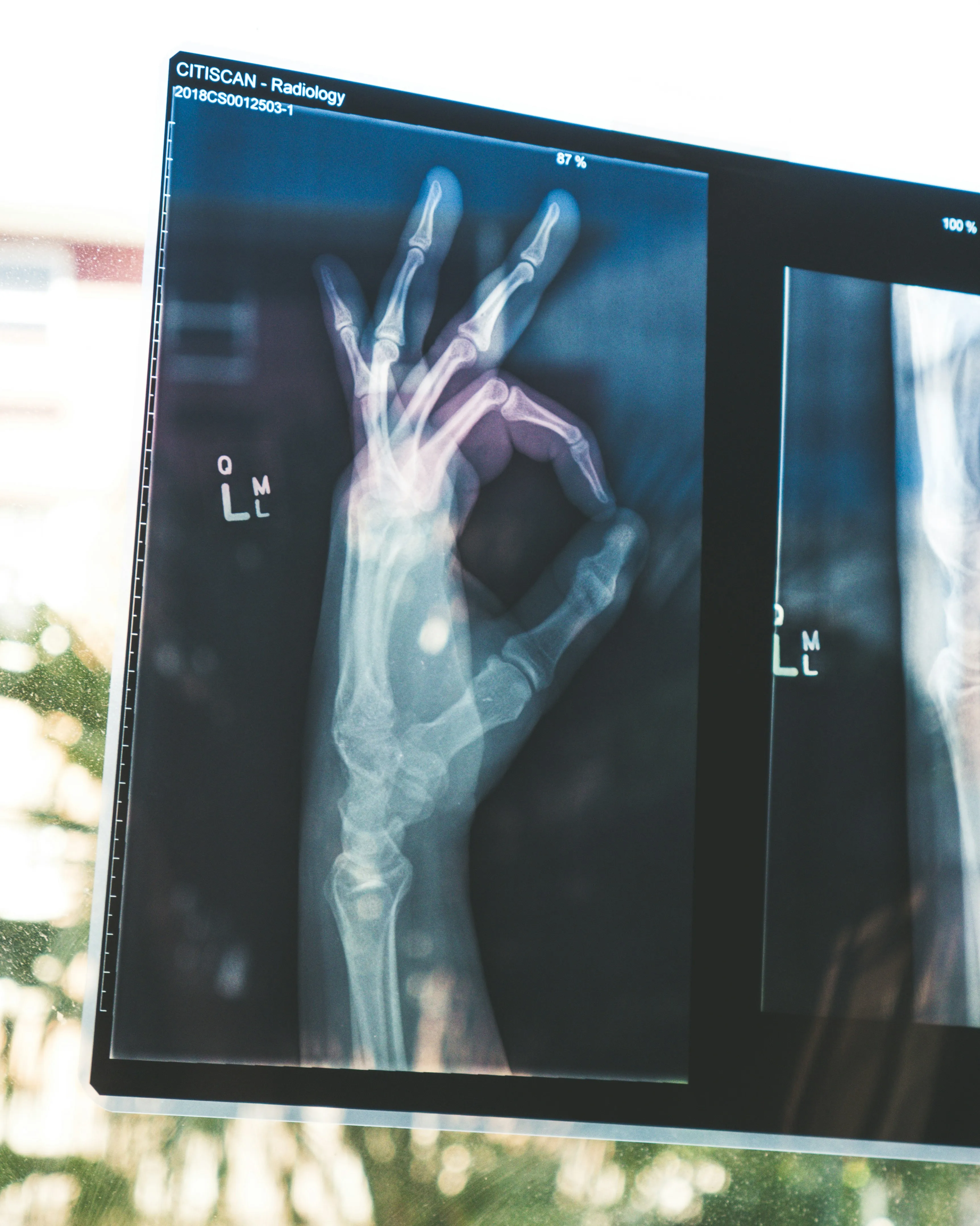 Digital X-ray displayed on screen for diagnostic review