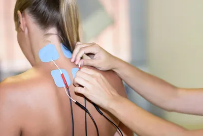 Electrical Stimulation