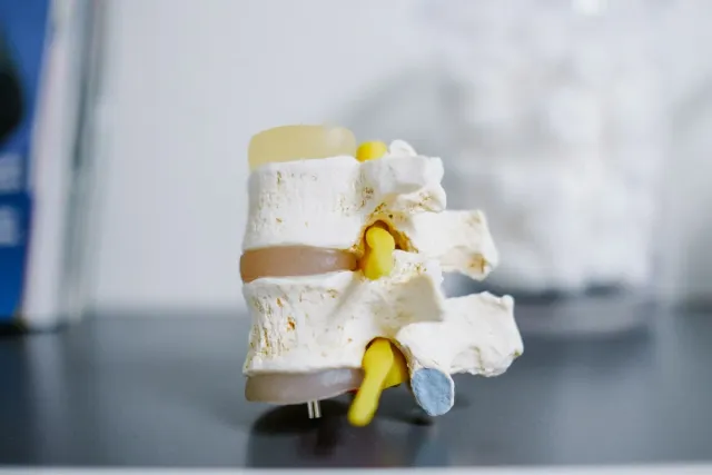 Spine model showing vertebrae and disc structure